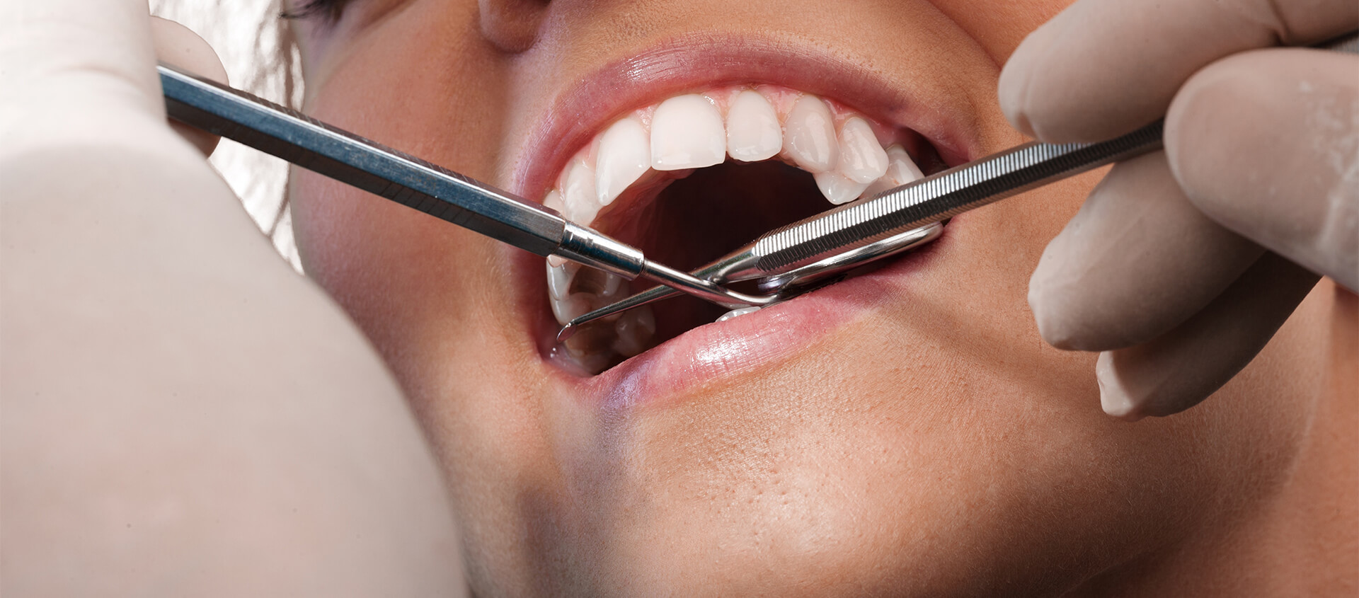 Teeth Removal Dentist in Thibodaux Area